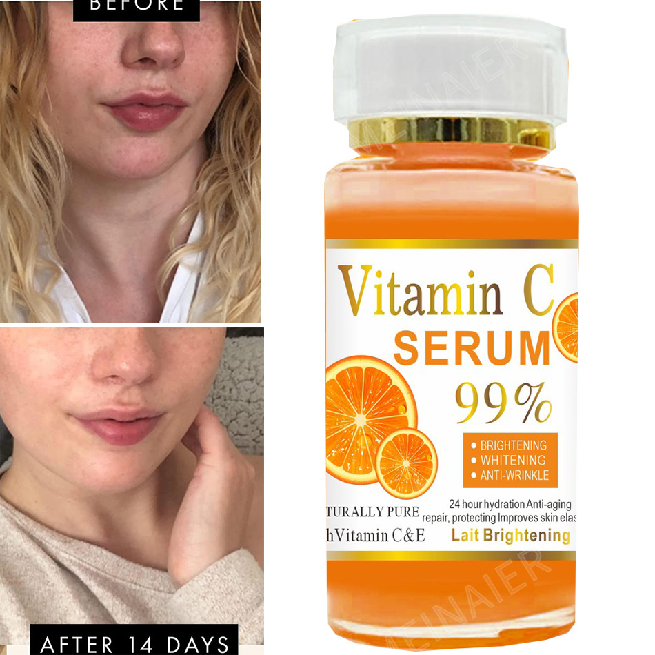 Vitamin C Serum Face - Super 120Ml Vitamine C Serum Anti-Aging