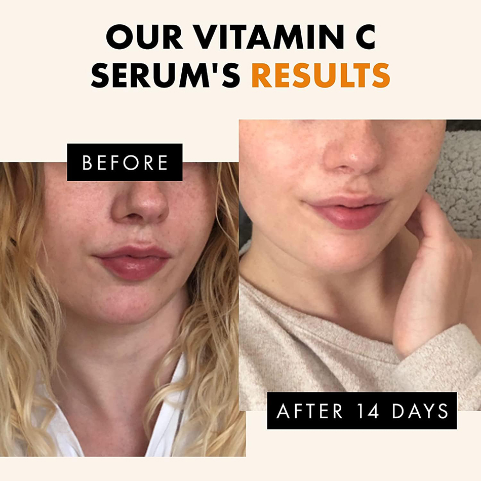 Super 120Ml Vitamine C Serum A - Vitamin C Serum Face recensie en prijs
